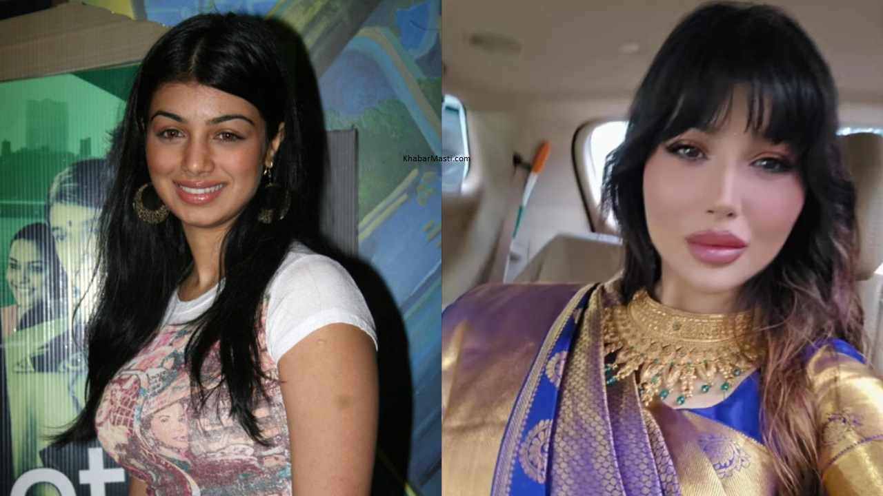 Ayesha Takia Before And After Surgery Ayesha Takia Before And After Surgery