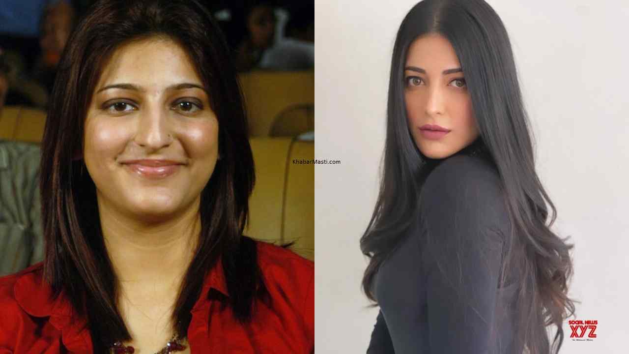 Shruti Haasan Before And After Surgery Shruti Haasan Before And After Surgery